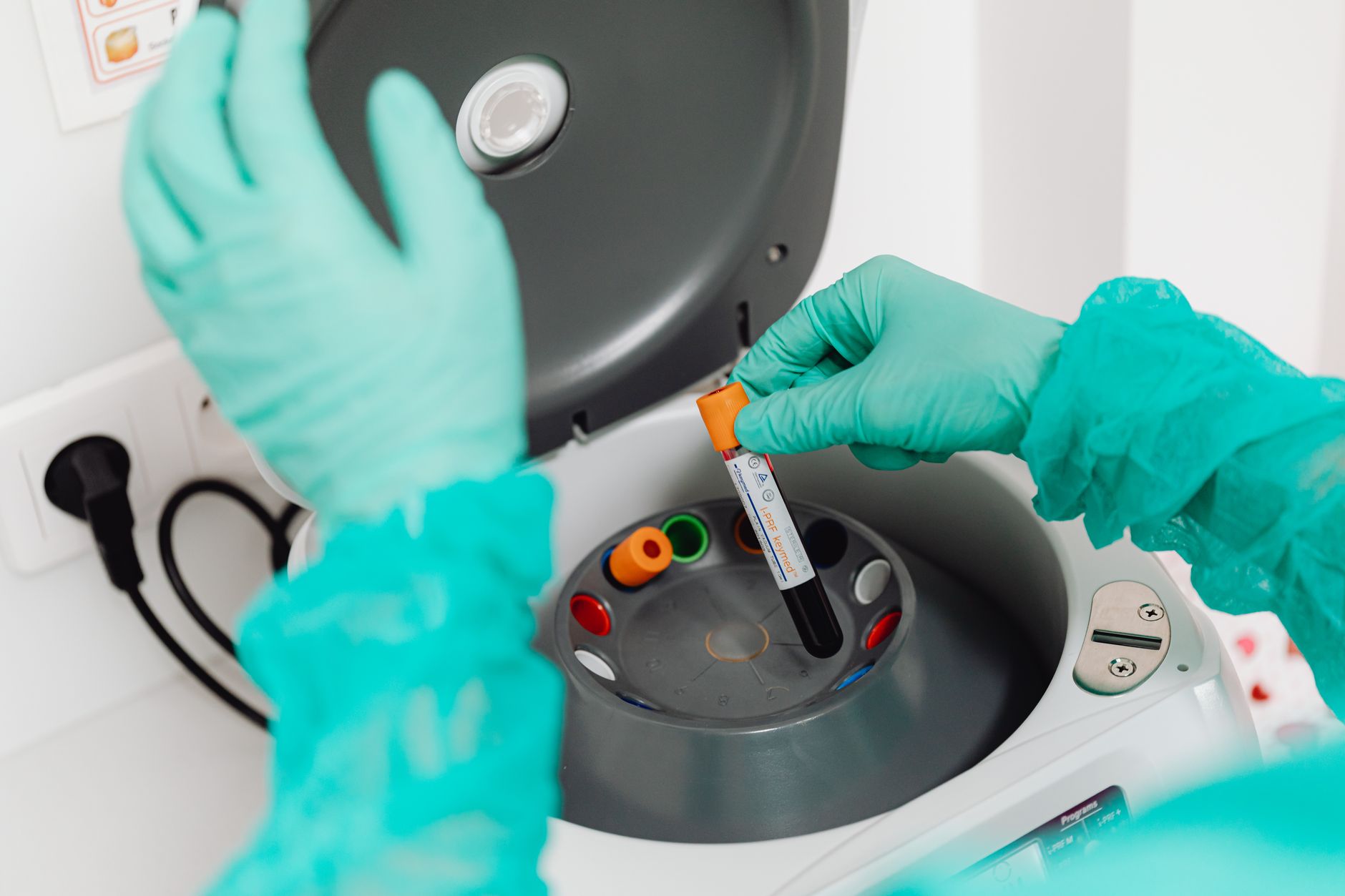 GRAL – The FDA Meets Wednesday on a Blood Test That Could Find 50 Cancers. The Stock Just Went Up a Third.
